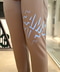 thumbail5